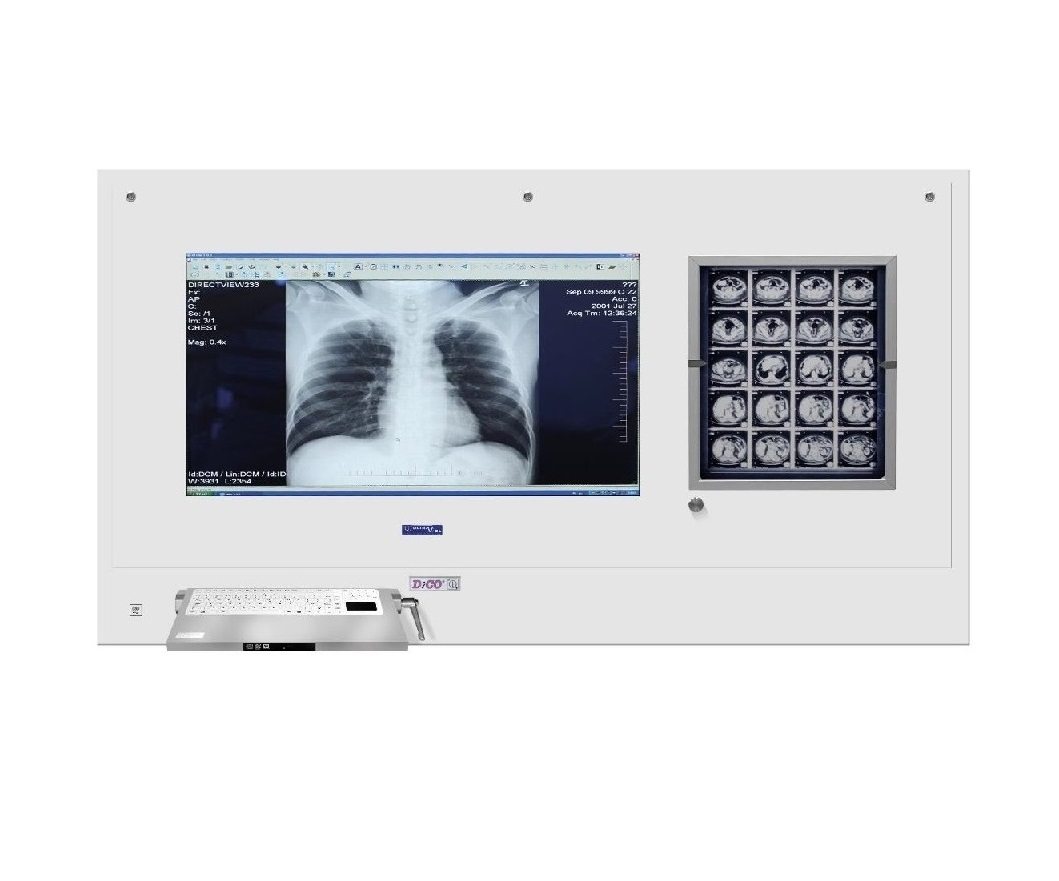 Stacje przeglądowe obrazów medycznych na sale operacyjne ULTRAVIOL DICO 1M/1B 49" STACJA PRZEGLĄDOWA CYFROWYCH OBRAZÓW MEDYCZNYCH