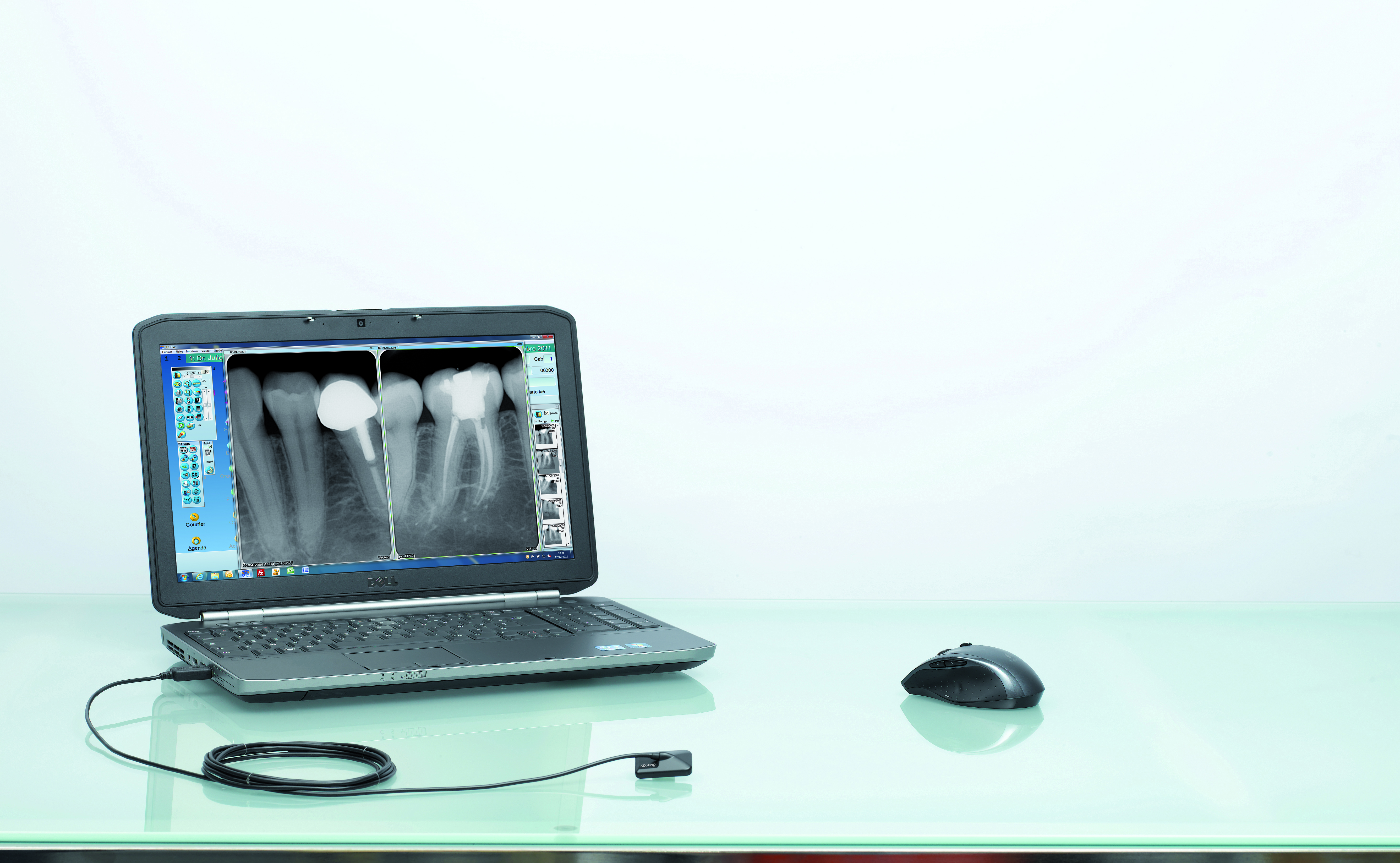 Stomatologiczne detektory cyfrowe Owandy Opteo USB T1 / Opteo USB T2