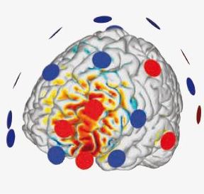 Stymulatory elektryczne przezczaszkowe (tCS) Neuroelectrics StarStim 20 EEG