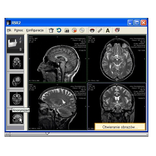 Systemy archiwizacji obrazów medycznych (PACS) Archimedic RSR 2