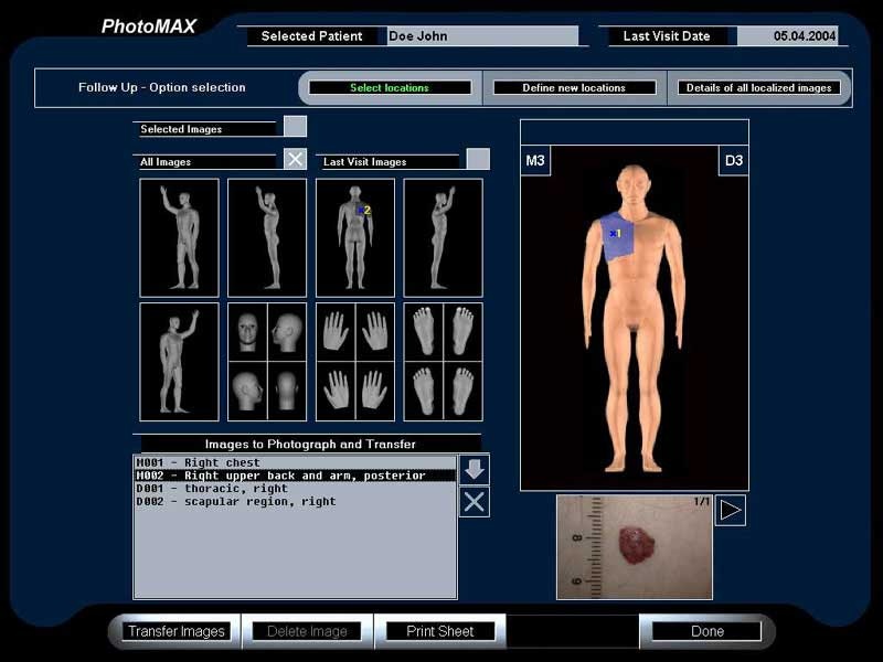 Systemy archiwizacji obrazów medycznych (PACS) DERMA MEDICAL PhotoMAX
