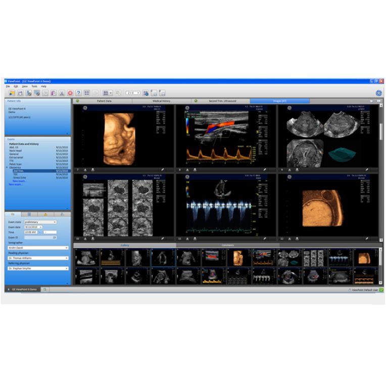 Systemy archiwizacji w położnictwie i ginekologii GE Healthcare ViewPoint