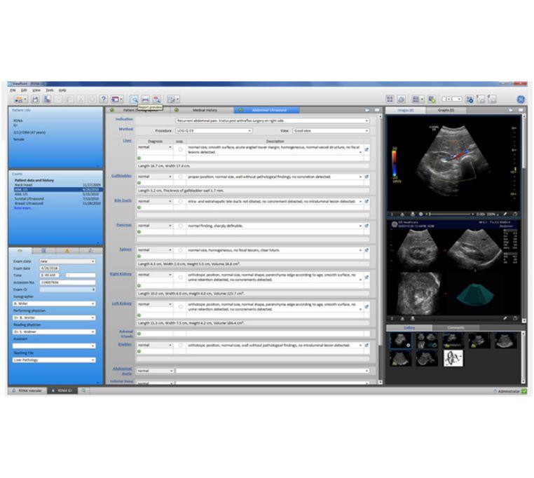 Systemy archiwizacji w położnictwie i ginekologii GE Healthcare ViewPoint