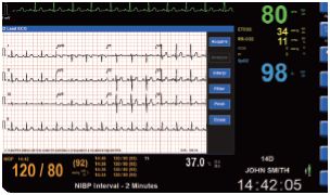 Systemy centralnego monitorowania – centrale pielęgniarskie Mortara Surveyor