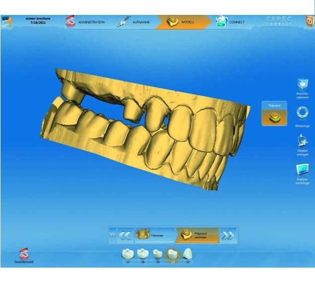 Systemy, frezarki protetyczne CAD/CAM Sirona Cerec Classic