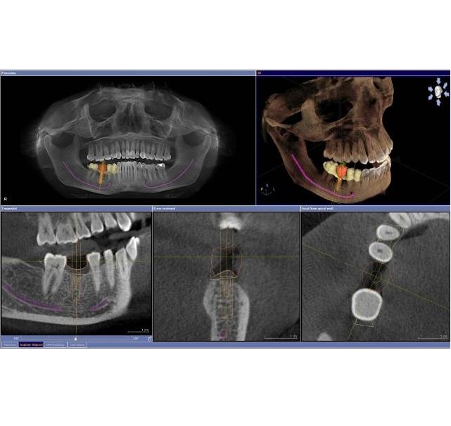 Systemy, frezarki protetyczne CAD/CAM Sirona Cerec Classic