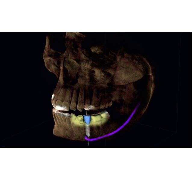 Systemy, frezarki protetyczne CAD/CAM Sirona Cerec Classic