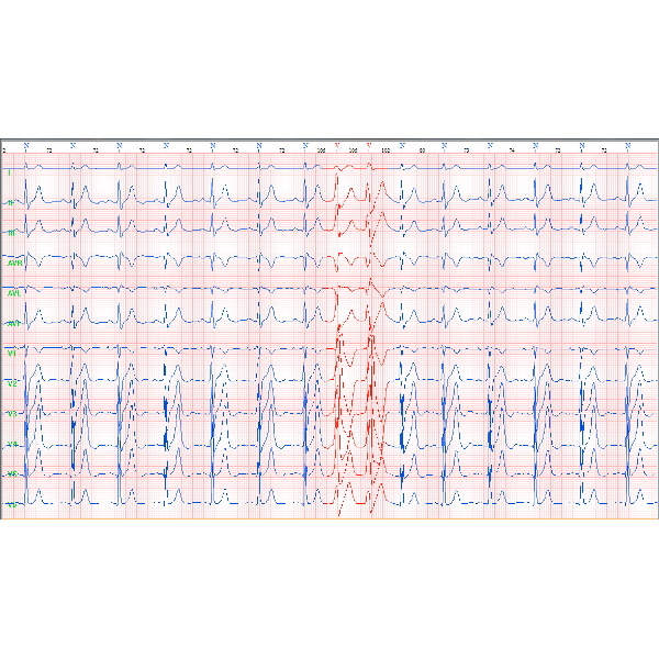 Systemy holterowskie EKG Biomedical Instruments Co., Ltd EcgLab