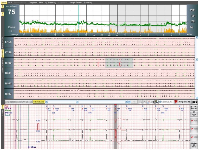 Systemy holterowskie EKG Labtech EC-12H