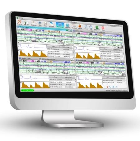 Systemy monitoringu położniczego KTG EDAN CENTRALA KTG