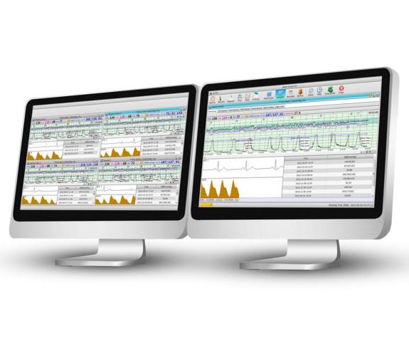 Systemy monitoringu położniczego KTG EDAN CENTRALA KTG