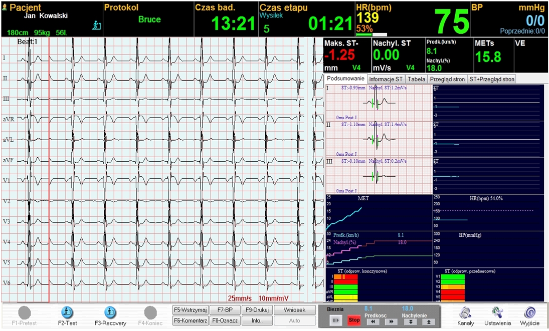 Systemy prób wysiłkowych DM Software CardioScan Stress Test 4.0