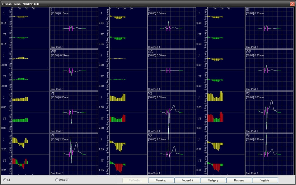 Systemy prób wysiłkowych DM Software CardioScan Stress Test 4.0