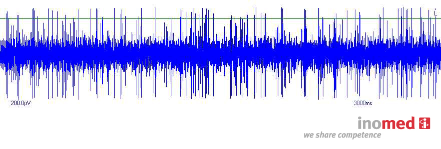 Systemy stereotaktyczne do neurochirurgii inomed Medizintechnik GmbH Microdrive