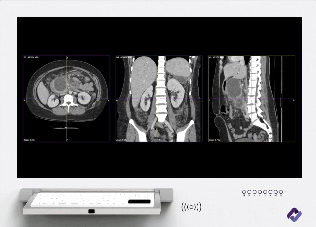 Systemy Zintegrowanych Sal Operacyjnych CureConsole CureConsole