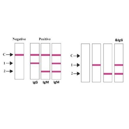 Testy do wykrywania przeciwciał koronawirusa SARS-CoV-2 COVID-19 Artron COVID-19 IgM/IgG Rapid Test Cassette (WB/S/P)