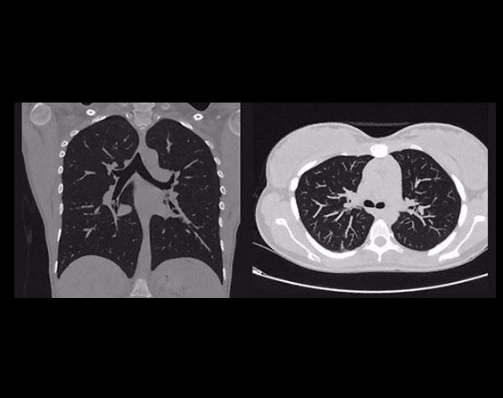Tomografy komputerowe (CT) PHILIPS Ingenuity Elite