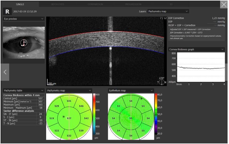 Tomografy okulistyczne (OCT) OPTOPOL REVO 80