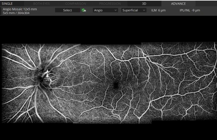 Tomografy okulistyczne (OCT) OPTOPOL REVO NX