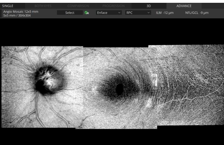 Tomografy okulistyczne (OCT) OPTOPOL REVO NX