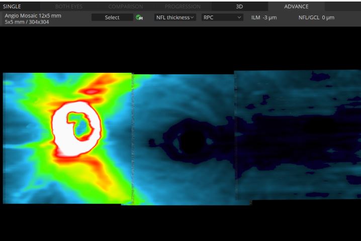 Tomografy okulistyczne (OCT) OPTOPOL REVO NX