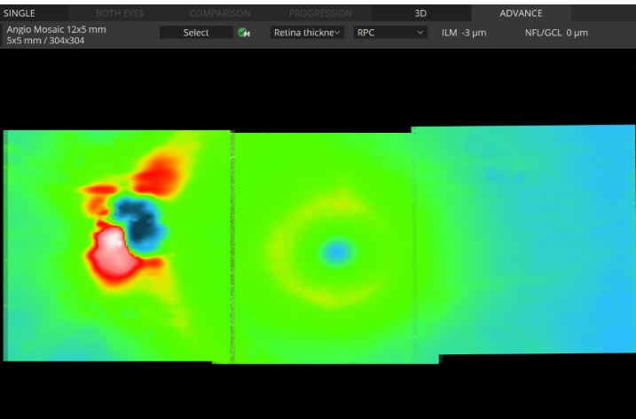 Tomografy okulistyczne (OCT) OPTOPOL REVO NX