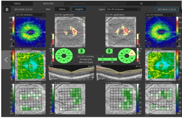 Tomografy okulistyczne (OCT) OPTOPOL REVO NX