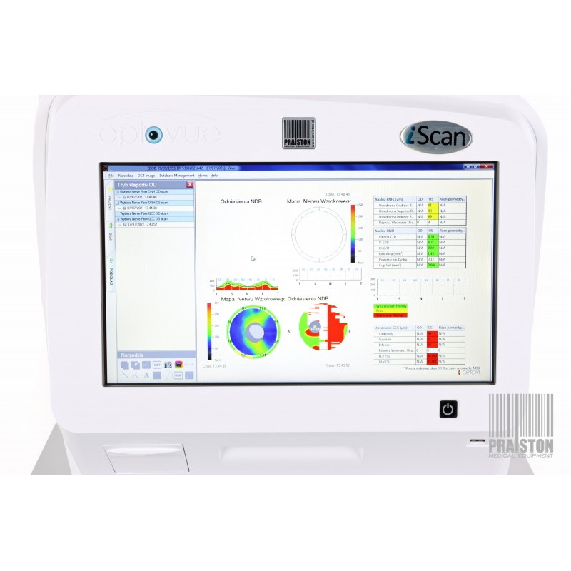 Tomografy okulistyczne (OCT)  używane B/D Optovue Iscan Ivue 500 - Praiston rekondycjonowany
