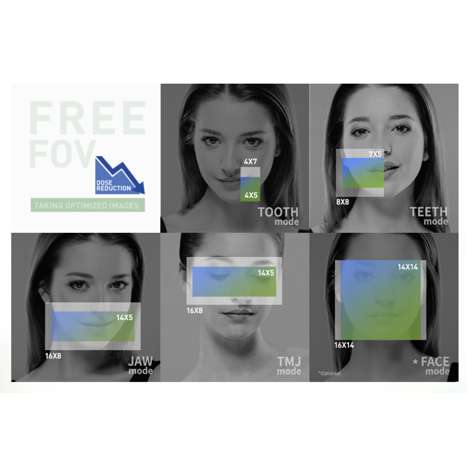 Tomografy stomatologiczne GENORAY Papaya