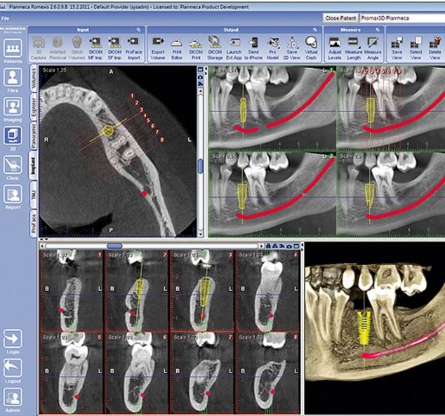 Tomografy stomatologiczne Planmeca ProMax 3D