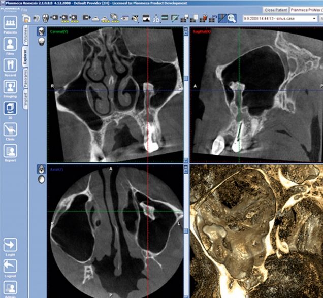 Tomografy stomatologiczne Planmeca ProMax 3D