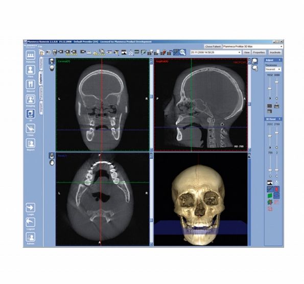 Tomografy stomatologiczne Planmeca ProMax 3D Max