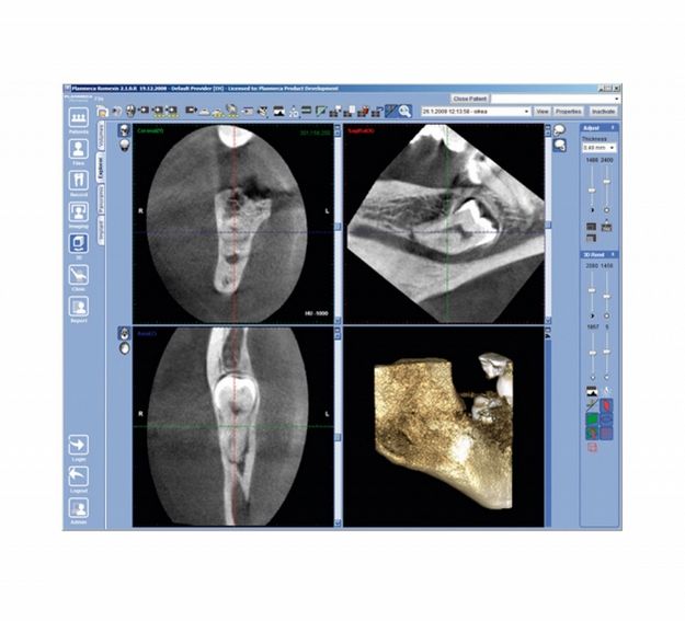 Tomografy stomatologiczne Planmeca ProMax 3D Max