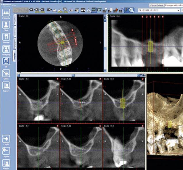 Tomografy stomatologiczne Planmeca ProMax 3Ds
