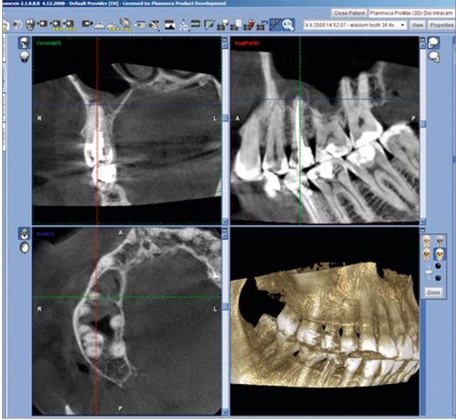 Tomografy stomatologiczne Planmeca ProMax 3Ds