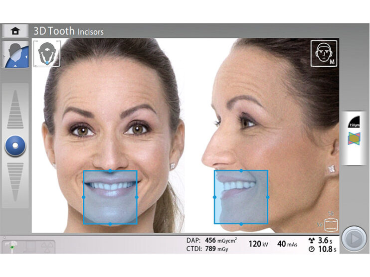 Tomografy stomatologiczne Planmeca Viso G5