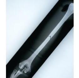 Układ kostny Nasco LF01210U