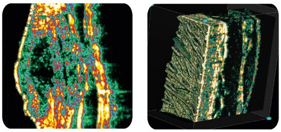 Ultrasonografy dermatologiczne Cortex Technology DermaScan C