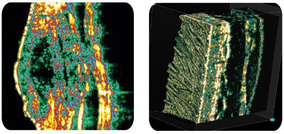 Ultrasonografy dermatologiczne Cortex Technology DermaScan USB