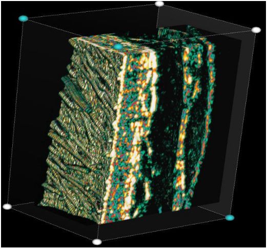 Ultrasonografy dermatologiczne Cortex Technology DermaScan USB