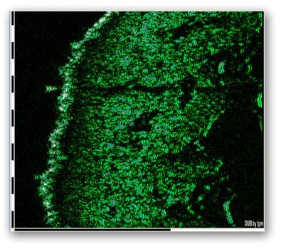 Ultrasonografy dermatologiczne tpm DUB 100-12 Bit