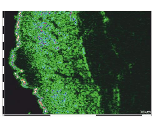 Ultrasonografy dermatologiczne tpm DUB SkinScanner75