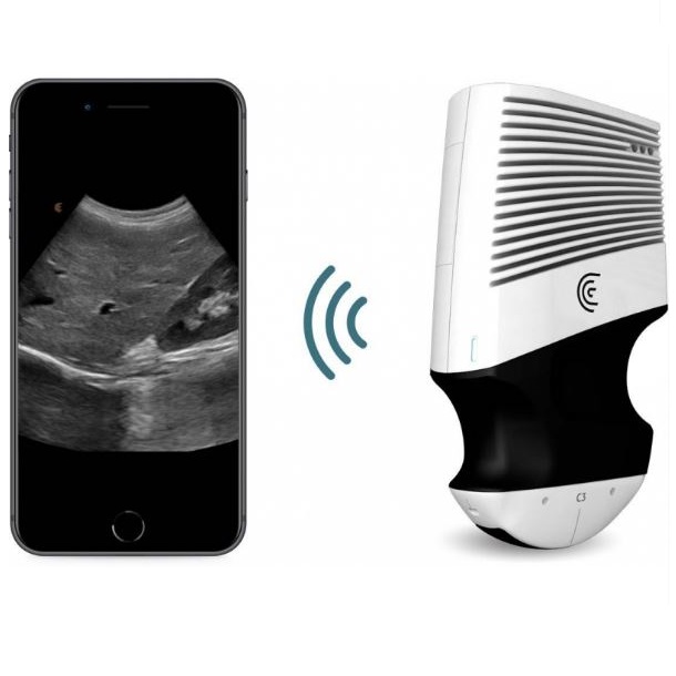 Ultrasonografy kieszonkowe ręczne (USG) Clarius C3