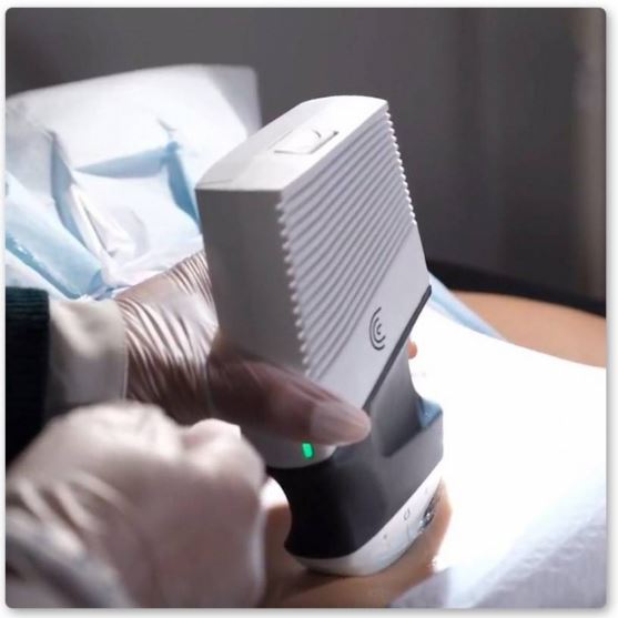 Ultrasonografy kieszonkowe ręczne (USG) Clarius C3