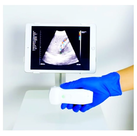 Ultrasonografy kieszonkowe ręczne (USG) MyUSG C10RL