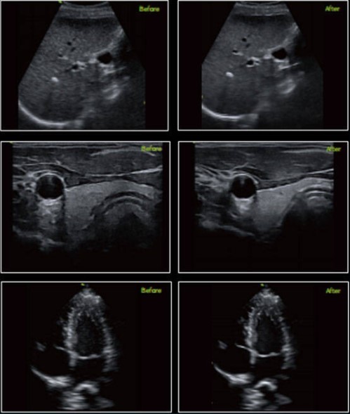 Ultrasonografy kieszonkowe ręczne (USG) Vinno Q5-7L