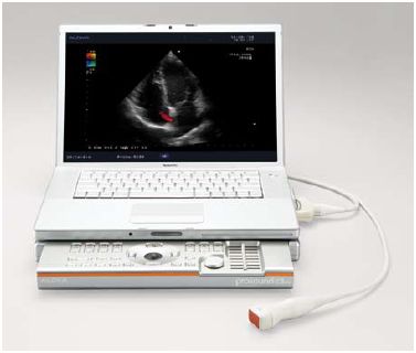 Ultrasonografy mobilne przyłóżkowe ALOKA Aloka ProSound SSD-3500SX