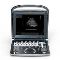 Ultrasonografy mobilne przyłóżkowe CHISON ECO 1