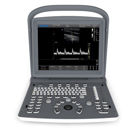 Ultrasonografy mobilne przyłóżkowe CHISON ECO 2
