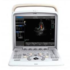 Ultrasonografy mobilne przyłóżkowe CHISON Q5